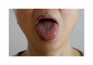 tongue 1    
